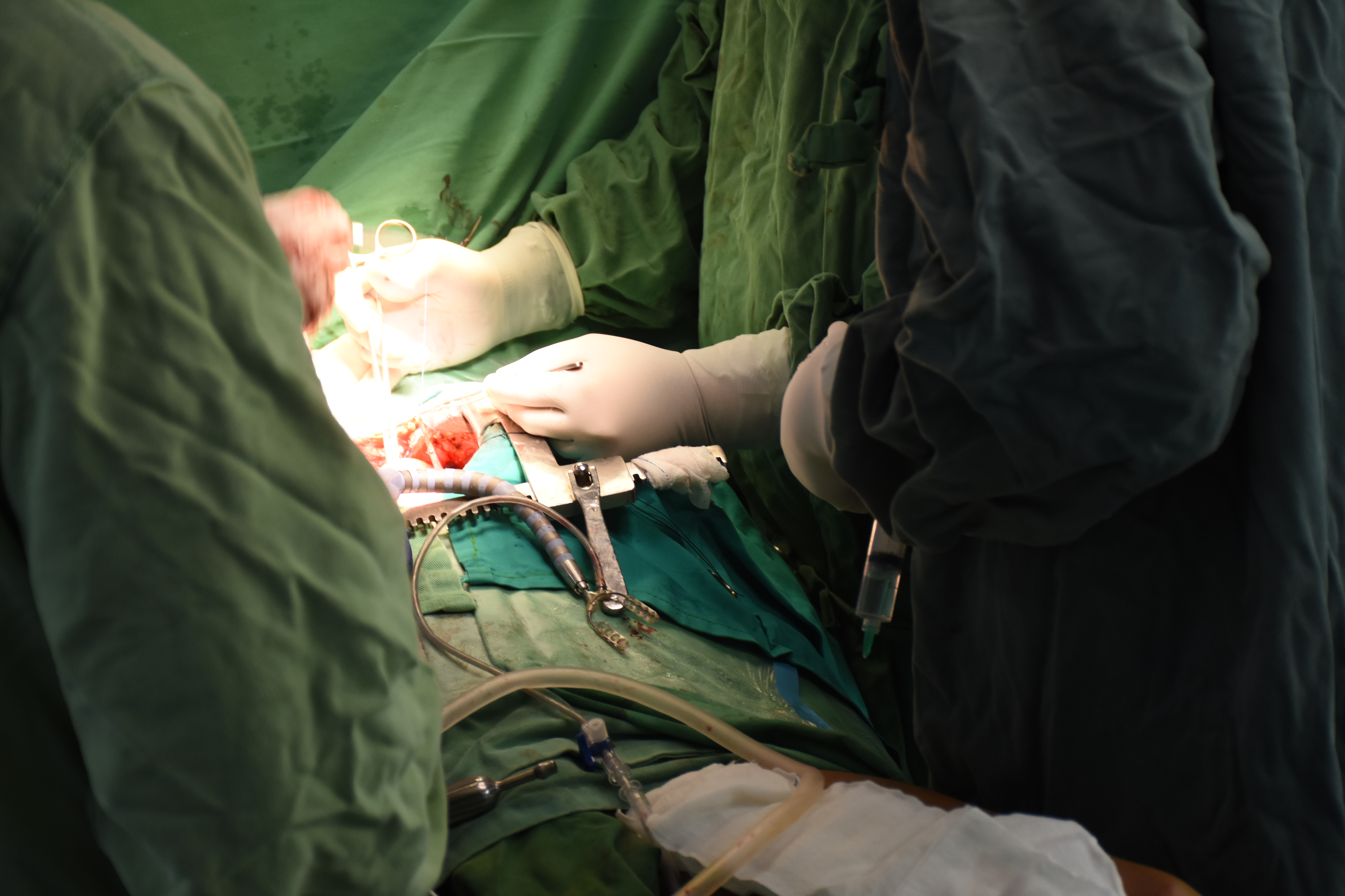 AFIC/NIHD- Adult Cardiac Surgery