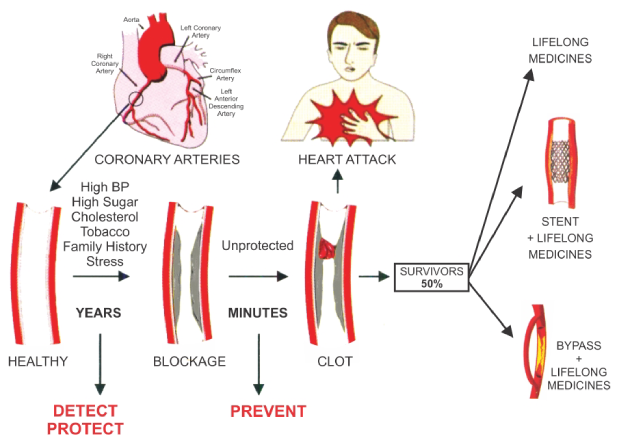 prevent-heart-attack-Fflowchart